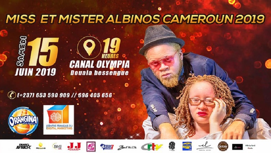 L’élection Miss et Mr albinos se tiendra le 15 juin prochain à Douala